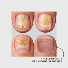 Charger l'image dans la galerie, ELIM NailFX 20ML